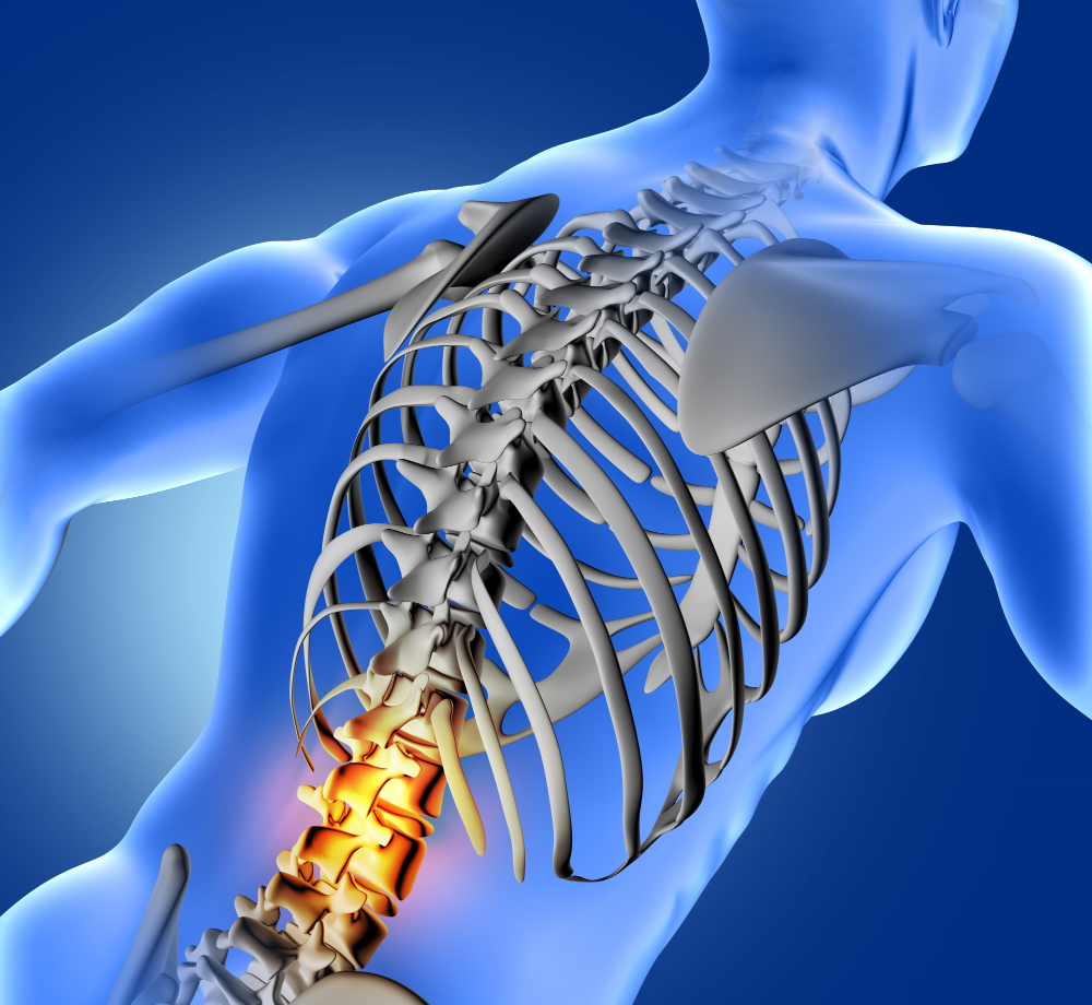 orthopedic implants suppliers in Delhi